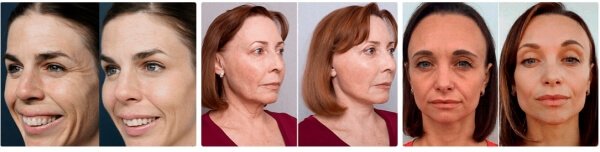 Introduction to ellesse cream opinie